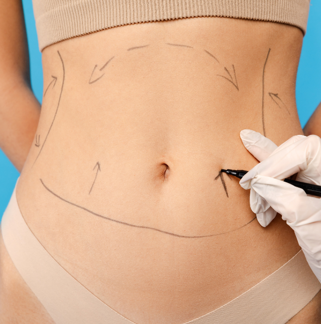 gtr Liposuction